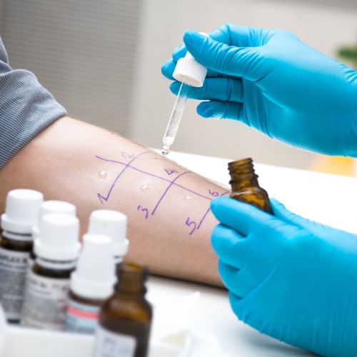Allergy test